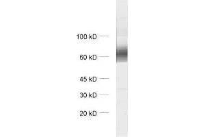 SLC6A1 anticorps  (AA 585-599)