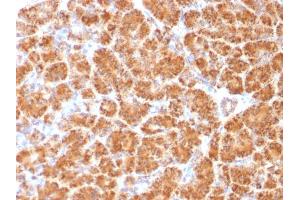 Formalin-fixed, paraffin-embedded human Pancreas stained with Clathrin, LC Monoclonal Antibody (CLC/1421).