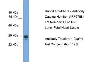 WB Suggested Anti-PRRX2  Antibody Titration: 0. (PRRX2 antibody  (Middle Region))