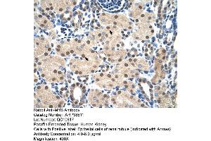 Immunohistochemistry (IHC) image for anti-V-Myb Myeloblastosis Viral Oncogene Homolog (Avian) (MYB) (N-Term) antibody (ABIN2780679)