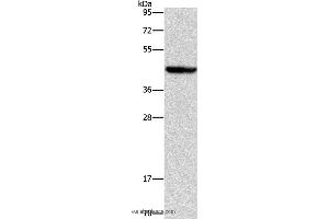Western blot analysis of Mouse liver tissue, using ORM2 Polyclonal Antibody at dilution of 1:700 (Orosomucoid 2 antibody)