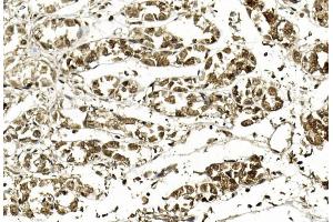 Immunohistochemistry (IHC) image for anti-Apurinic/Apyrimidinic Endonuclease 1 (APEX1) antibody (ABIN6242774)