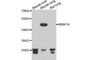 Western blot analysis of extracts of various cell lines, using MMP19 antibody. (MMP19 antibody)