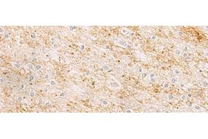 Immunohistochemistry of paraffin-embedded Human brain tissue using RHCG Polyclonal Antibody at dilution of 1:25(x200) (RHCG antibody)