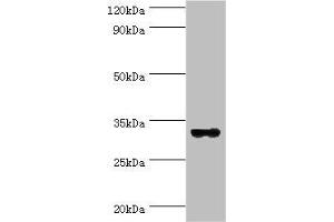 Western blot All lanes: STX11 antibody at 6 μg/mL + Mouse skeletal muscle tissue Secondary Goat polyclonal to rabbit IgG at 1/10000 dilution Predicted band size: 33 kDa Observed band size: 33 kDa