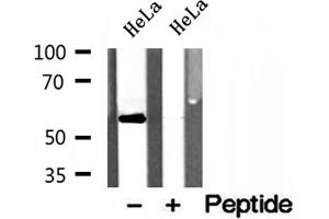Western blot analysis of extracts of HeLa cells, using PDLIM7 antibody.