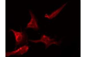 ABIN6275578 staining 293 by IF/ICC. (SCN2B antibody  (Internal Region))