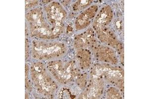 Immunohistochemical staining of human kidney with ZNF234 polyclonal antibody  shows distinct nuclear and moderate cytoplasmic positivity in cells in tubules at 1:50-1:200 dilution.