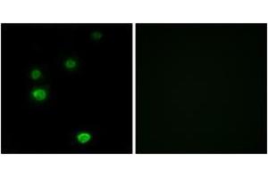 Immunofluorescence analysis of LOVO cells, using RPC5 Antibody. (POLR3E antibody  (AA 191-240))
