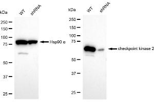 Western blotting analysis using checkpoint kinase 2 antibody (ABIN7798040). (Recombinant CHEK2 antibody)