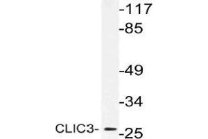 Western blot (WB) analysis of CLIC3 antibody in extracts from MCF-7 cells. (CLIC3 antibody)