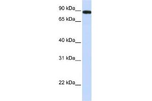 WB Suggested Anti-FAM47A Antibody Titration: 0. (FAM47A antibody  (Middle Region))