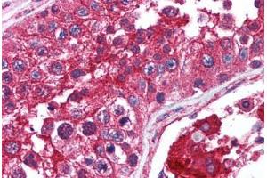 Human Testis (formalin-fixed, paraffin-embedded) stained with mTOR antibody ABIN214561 at 2. (MTOR antibody  (AA 2440-2457))