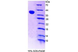 SDS-PAGE (SDS) image for Receptor-Interacting Serine-threonine Kinase 2 (RIPK2) (AA 1-294) protein (His tag) (ABIN6238921) (RIPK2 Protein (AA 1-294) (His tag))
