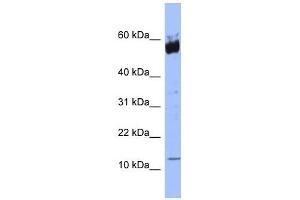 S100A9 antibody used at 1 ug/ml to detect target protein. (S100A9 antibody  (N-Term))