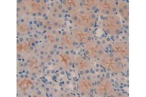 Used in DAB staining on fromalin fixed paraffin- embedded kidney tissue (ABCB7 antibody  (AA 472-752))