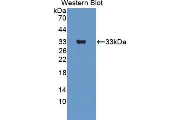 ERBB3 Antikörper  (AA 707-964)