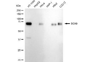 Western blotting analysis using SOX9 antibody (ABIN7800973). (Recombinant SRY-Box Transcription Factor 9 antibody)