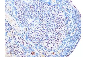Immunohistochemistry of paraffin-embedded rat ovary using SUMO2/3 Rabbit mAb (ABIN7270370) at dilution of 1:100 (40x lens). (SUMO2 antibody)