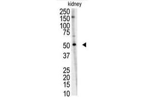 Image no. 1 for anti-Ring Finger Protein 216 (RNF216) (C-Term) antibody (ABIN357474) (RNF216 antibody  (C-Term))