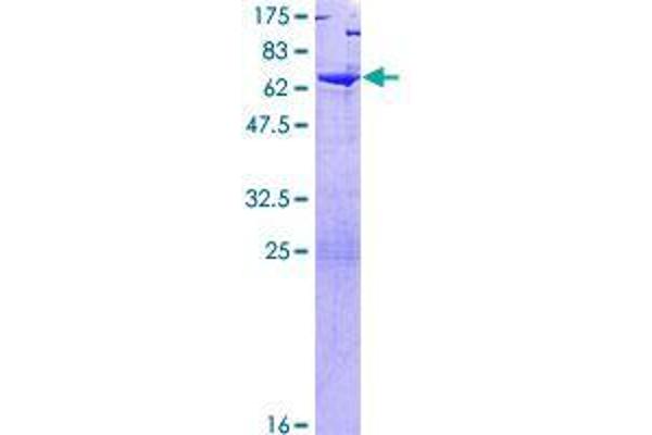 Tsnaxip1 Protein (AA 1-366) (GST tag)