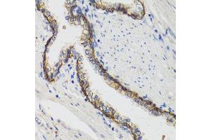 Immunohistochemistry of paraffin-embedded human prostate using ATP1A1 antibody (ABIN1871152) at dilution of 1:100 (40x lens). (ATP1A1 antibody)
