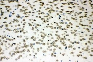 IHC analysis of Sumo 1/SUMO1 using anti-Sumo 1/SUMO1 antibody (ABIN7603002).