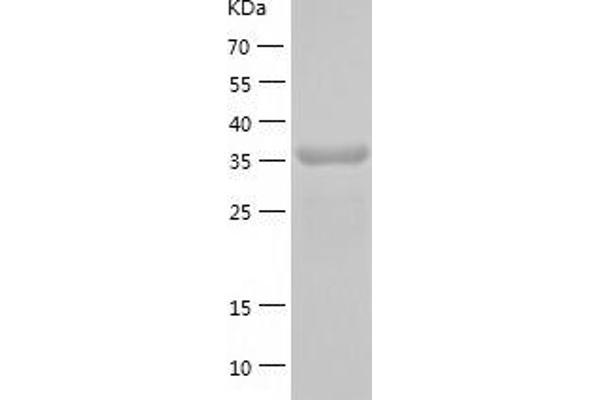 DHODH Protein (AA 31-395) (His tag)