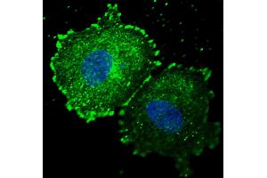 Fluorescent confocal image of MCF7 cells stained with phospho-ERBB2- antibody.