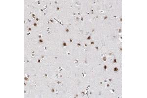 Immunohistochemical staining of human cerebral cortex with ADAR polyclonal antibody  shows strong nuclear positivity in neuronal cells at 1:1000-1:2500 dilution. (ADAR antibody)