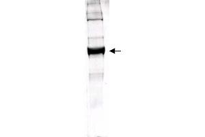 Figure 1. (GLUD1 antibody)