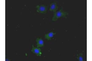 Immunohistochemistry (IHC) image for anti-High Mobility Group Box 1 (HMGB1) (AA 1-215) antibody (ABIN7425836)