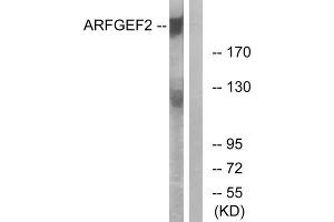 Western blot analysis of extracts from A549 cells, using ARFGEF2 antibody.