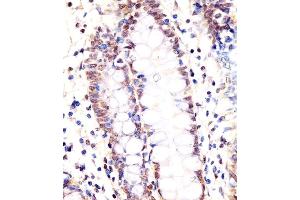 (ABIN6243725 and ABIN6578368) staining LSM2 in human colon tissue sections by Immunohistochemistry (IHC-P - paraformaldehyde-fixed, paraffin-embedded sections). (LSM2 antibody  (AA 55-89))