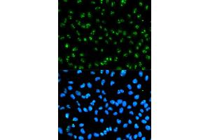Immunofluorescence analysis of HeLa cells using FBL antibody. (Fibrillarin antibody)