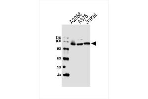 Lane 1: A2058, Lane 2: A375, Lane 3: Jurkat cell lysate at 20 µg per lane, probed with bsm-51428M MAGED1 (1305CT862. (MAGED1 antibody)
