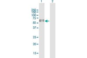 Western Blot analysis of ANTXR2 expression in transfected 293T cell line by ANTXR2 MaxPab polyclonal antibody. (ANTXR2 antibody  (AA 1-488))