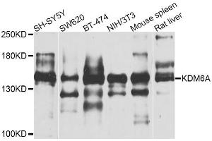 Western blot analysis of extracts of various cell lines, using KDM6A antibody (ABIN5974652) at 1/1000 dilution. (KDM6A antibody)