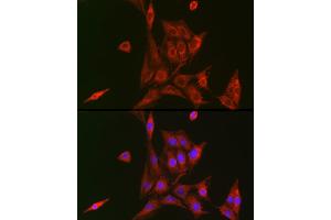 Immunofluorescence analysis of BALB-3T3 cells using NFKB1 Rabbit pAb (ABIN7268980) at dilution of 1:100 (40x lens).