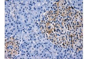 Immunohistochemical staining of paraffin-embedded liver tissue using anti-RPA2 mouse monoclonal antibody. (RPA2 antibody)