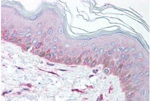 Human Skin (formalin-fixed, paraffin-embedded) stained with EEA1 antibody ABIN214099 at 5 ug/ml followed by biotinylated goat anti-rabbit IgG secondary antibody ABIN481713, alkaline phosphatase-streptavidin and chromogen. (EEA1 antibody  (AA 307-356))