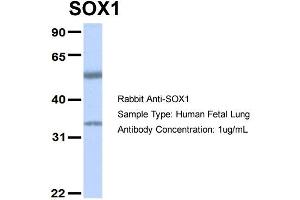 Western Blotting (WB) image for anti-SRY (Sex Determining Region Y)-Box 1 (SOX1) (Middle Region) antibody (ABIN2777427)