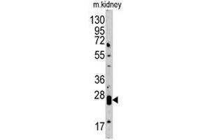 Western blot analysis of CLDN1 polyclonal antibody  in mouse kidney tissue lysate (35 ug/lane). (Claudin 1 antibody)