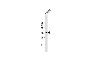 Anti-IgA Antibody (C-term) at 1:1000 dilution +  whole cell lysate Lysates/proteins at 20 μg per lane. (IGHA1 antibody  (C-Term))