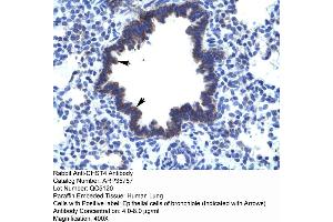 Human Lung (CHST4 antibody  (Middle Region))