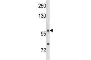 Western blot analysis of NRP1 antibody and MDA-MB435 lysate (Neuropilin 1 antibody  (AA 722-750))