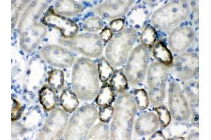 CASR was detected in paraffin-embedded sections of rat kidney tissues using rabbit anti- CASR Antigen Affinity purified polyclonal antibody (Catalog # ) at 1 µg/mL. (CASR antibody  (AA 926-1078))