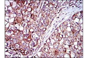 Immunohistochemistry (IHC) image for anti-Zinc Finger Protein 42 (ZFP42) (AA 249-310) antibody (ABIN1846770) (ZFP42 antibody  (AA 249-310))