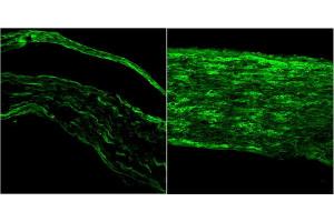 ABIN5539690 (1µg/ml) staining of PFA-perfused cryosection of Mouse sciatic nerve (left) and injured sciatic nerve (right). (BDNF antibody  (Internal Region))