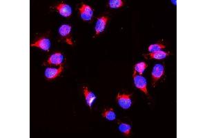 IF analysis of Peroxiredoxin 1 using anti- Peroxiredoxin 1 antibody (ABIN3043903). (Peroxiredoxin 1 antibody  (Middle Region))